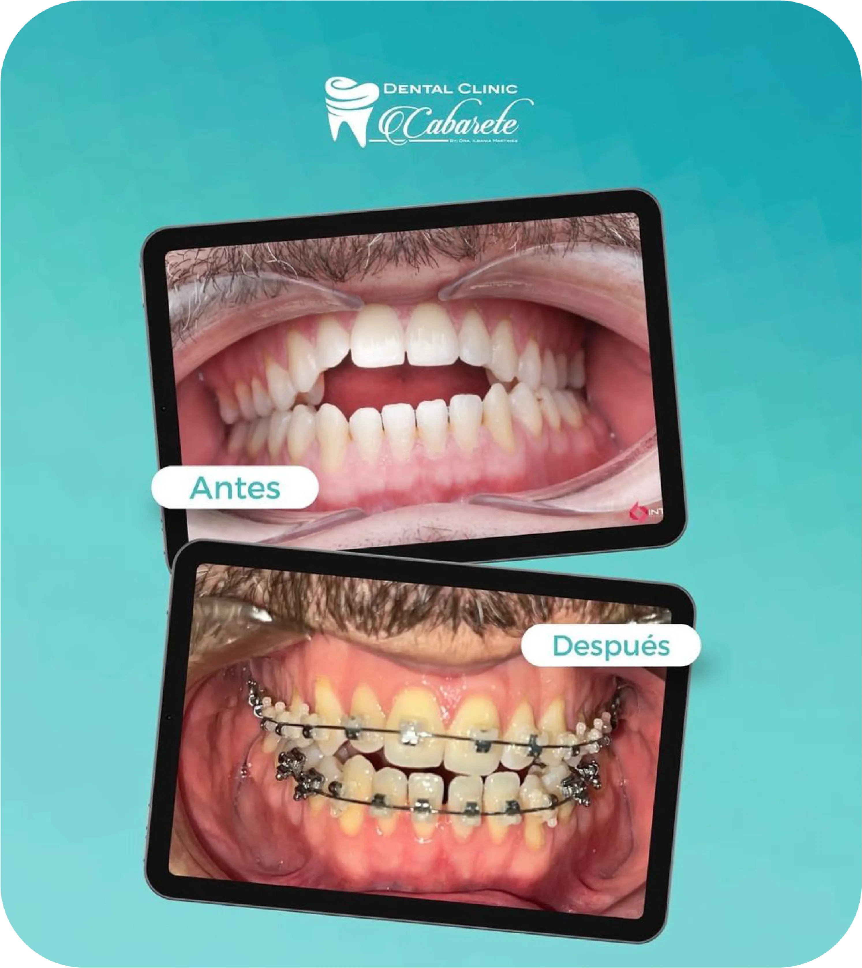 Before and after dental result 1
