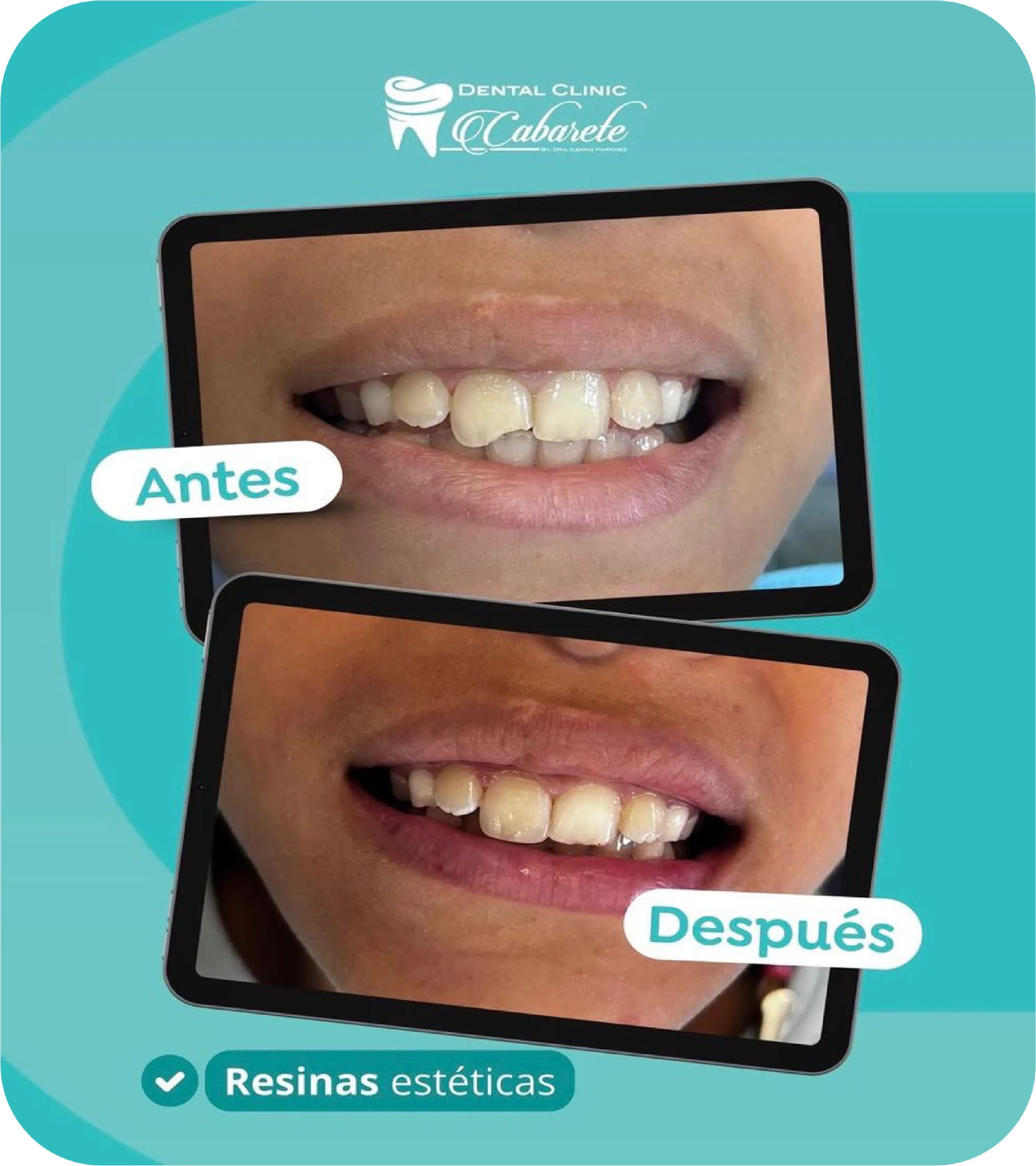 Before and after dental result 3